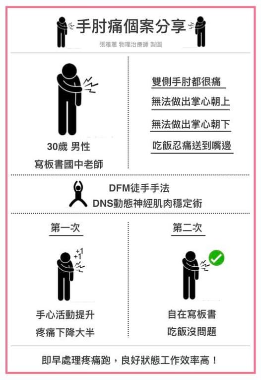 張雅蕙物理治療 手肘痛個案分享 DFM 徒手手法治療
