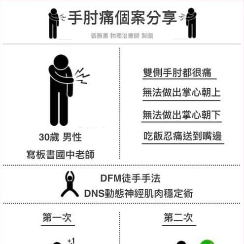 物理治療 DNS 案例分享 手肘痛